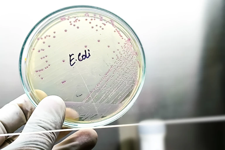 E coli on a petri dish.
