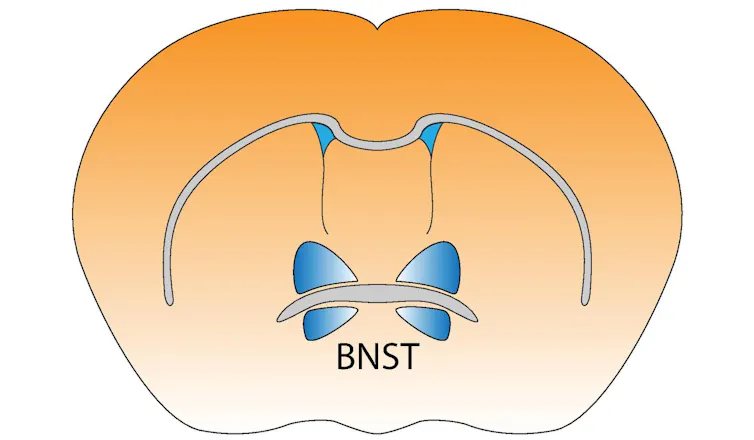 Diagram of brain silhouette with two small butterfly-wing shaped parts highlighted near the center