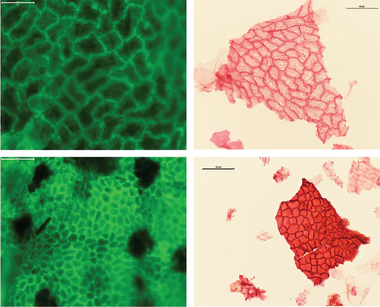 Four images show the differences between elongated and rounded cells in leaves.