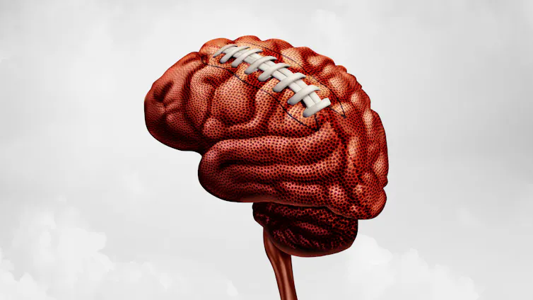 A creative image of a brain that looks like a deflated football is shown.