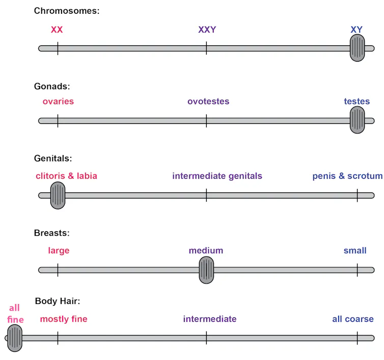 Five sliding scales depicting an individual's range of chromosomes, gonads, genitals, breasts and body hair