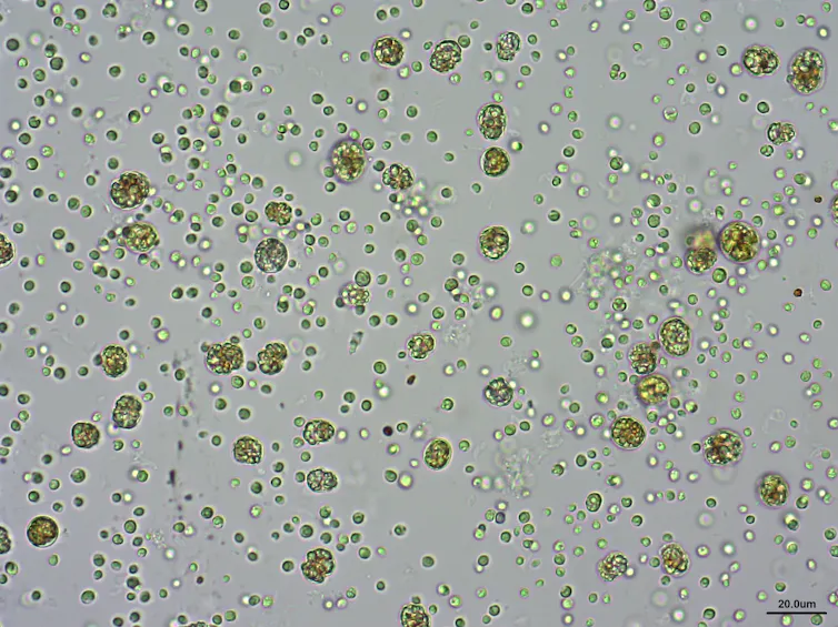 Fitoplacton visto al microscopio