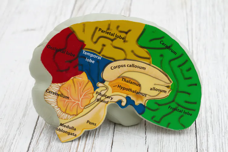 Model brain with anatomy on weathered wood.