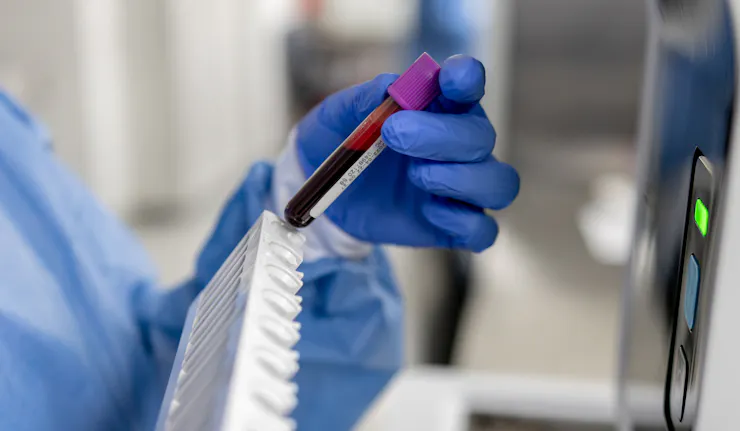 Person in PPE holding a vial of blood with a purple top