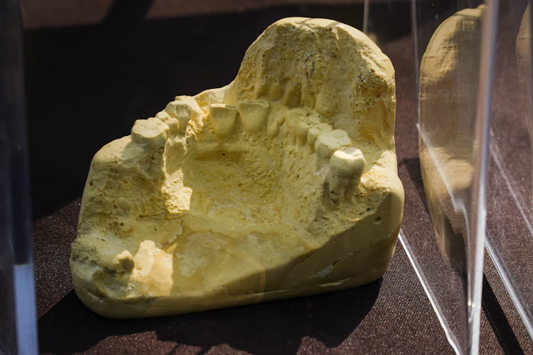 A set of teeth set in what appears to be a yellow rocklike material