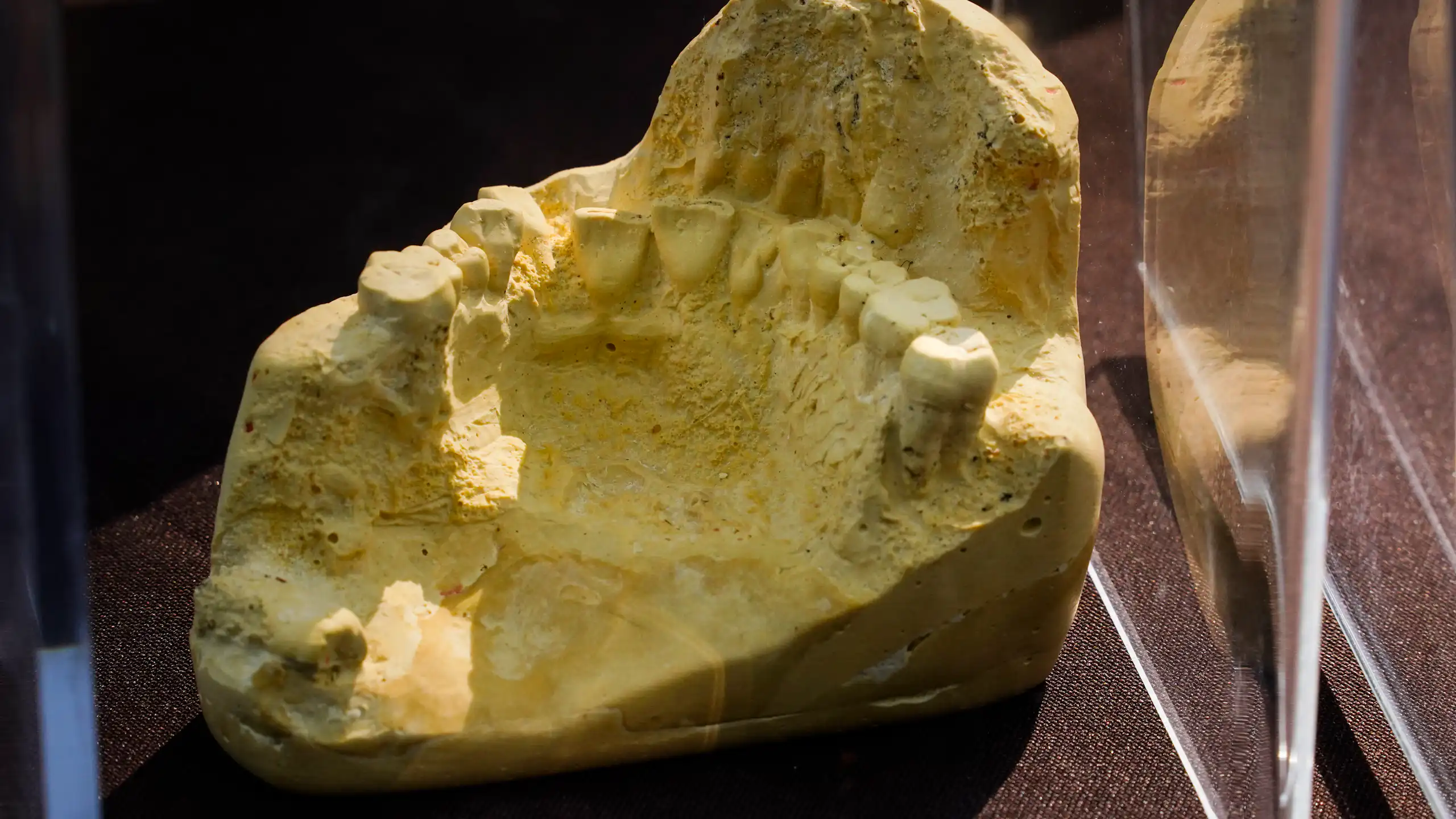 A set of teeth set in what appears to be a yellow rocklike material