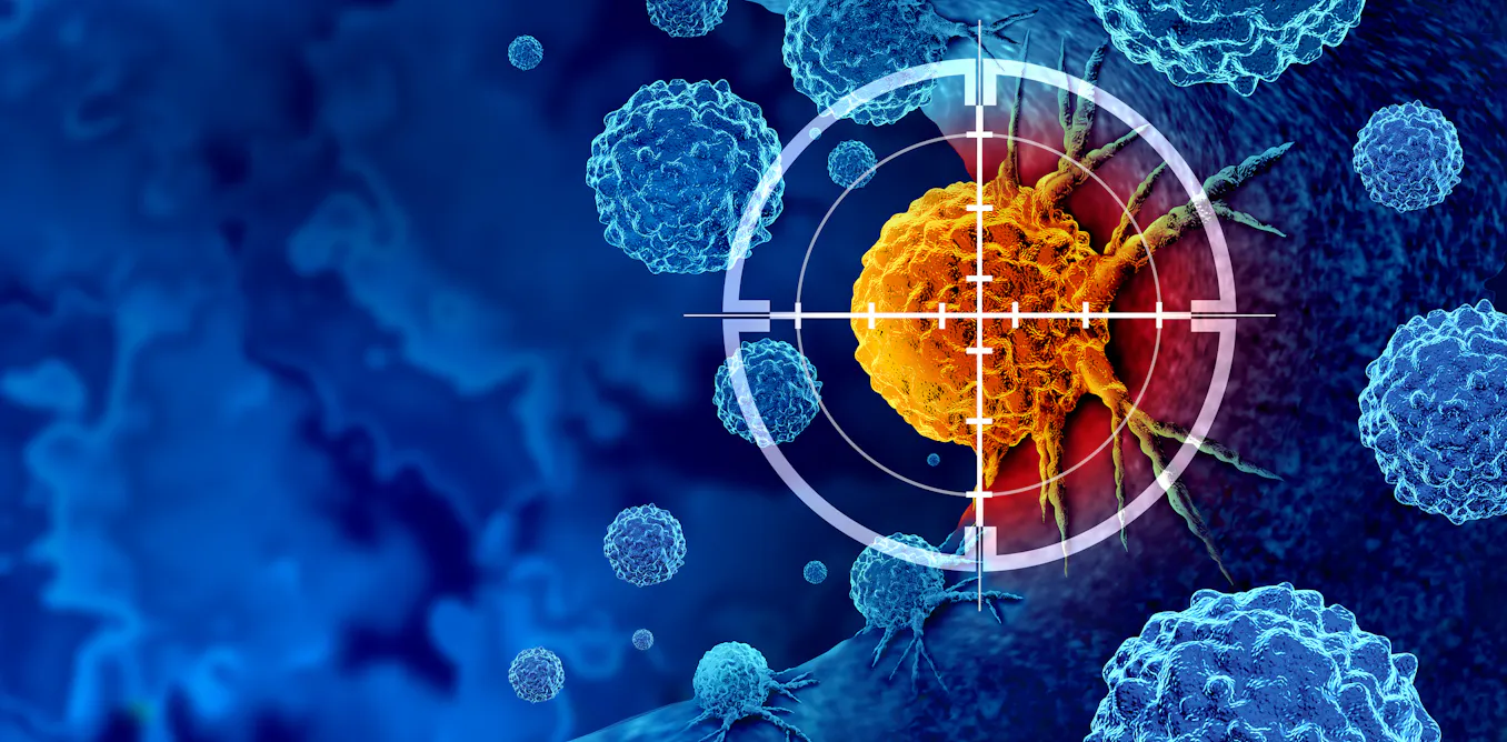 FDA approves breakthrough pancreatic cancer drug – an oncologist explains how daraxonrasib nearly doubles survival
