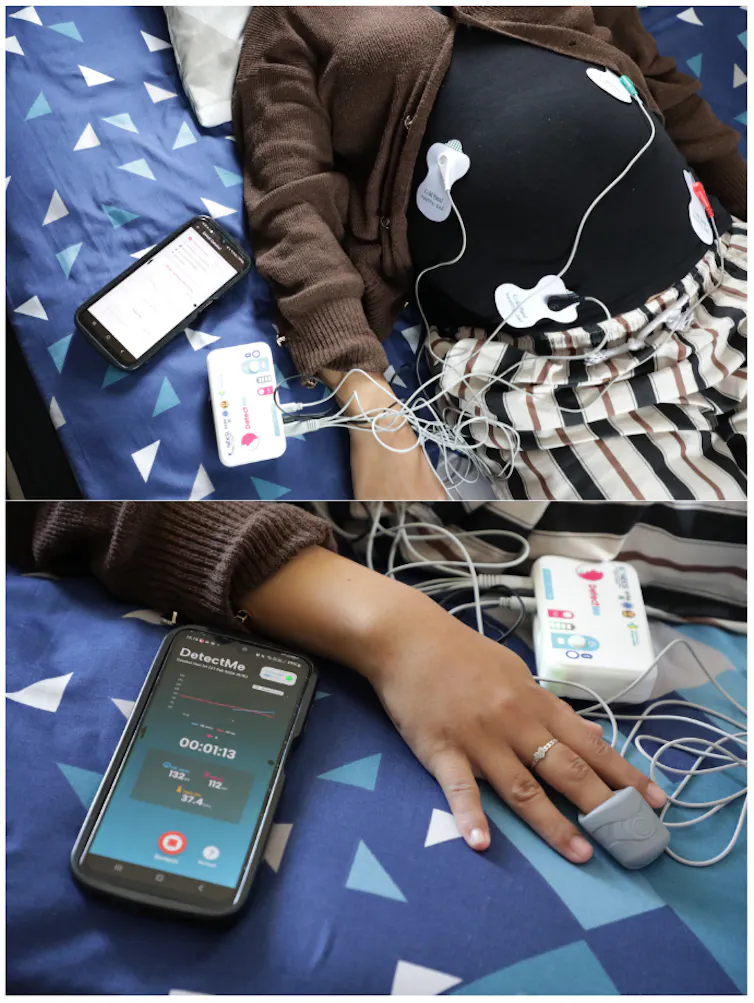 Perangkat DetectMe bekerja dengan menangkap gelombang jantung ibu dan janin lewat elektroda yang ditempelkan ke perut ibu.