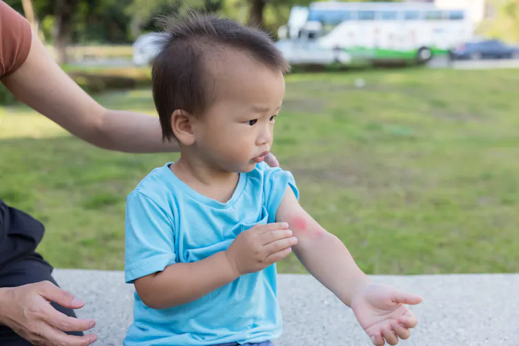 A toddler scratches at a red mosquito bite on the inside of their arm.