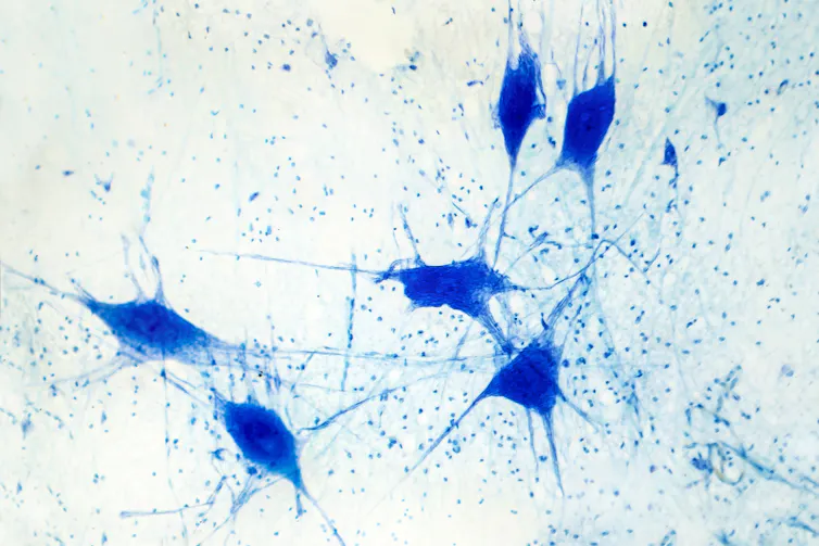 A light micrograph of human brain tissue showing neurons and glial cells.
