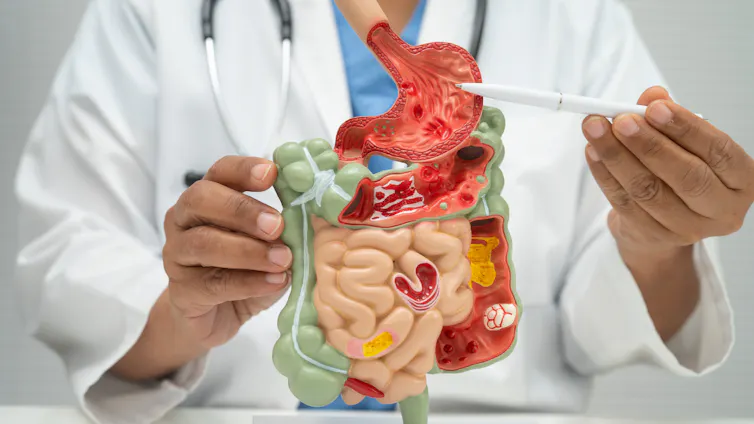 A doctor points to a model of the human digestive system