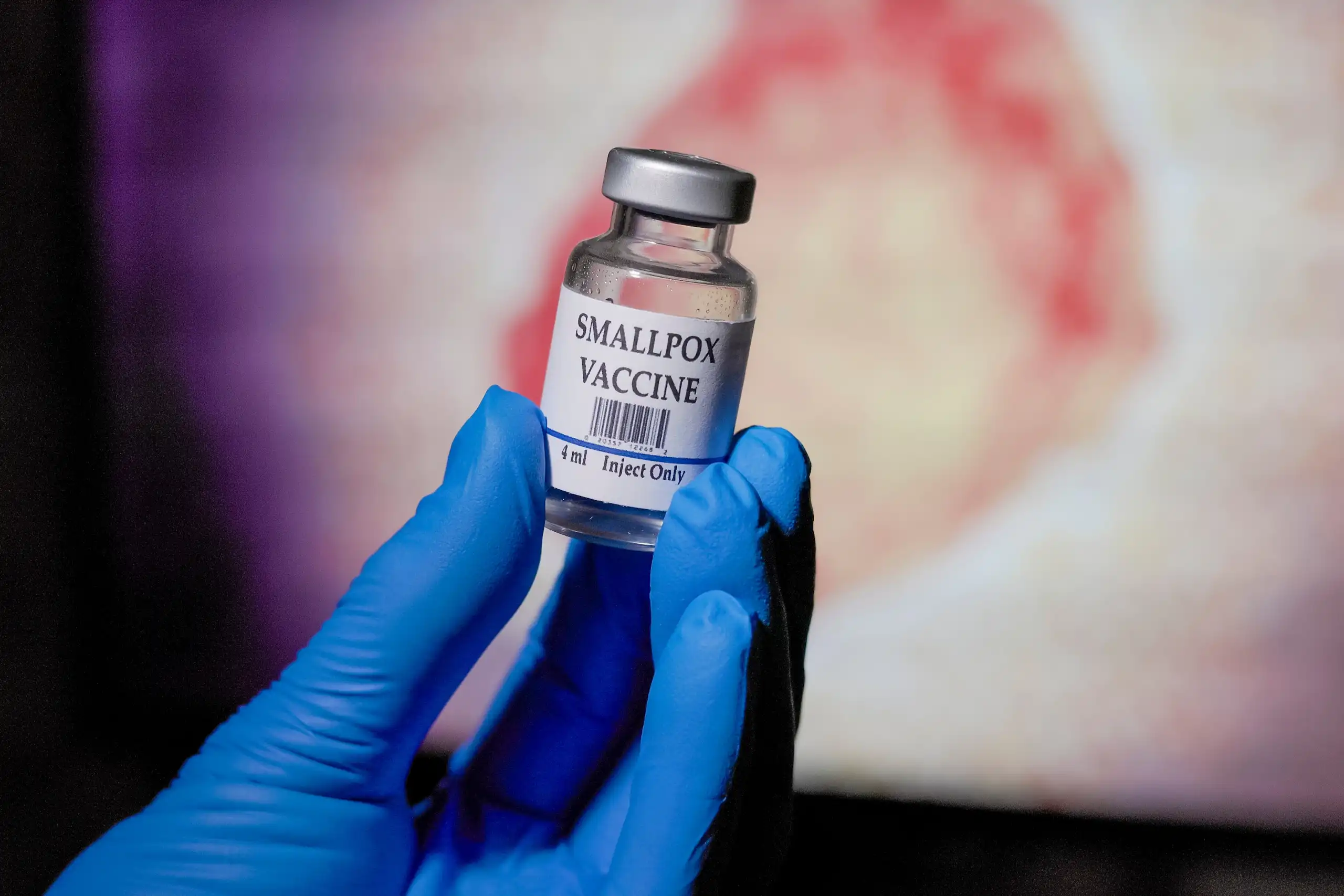 Blue gloved hand holding a vial of smallpox vaccine in front of the monkeypox virus graphic on a monitor