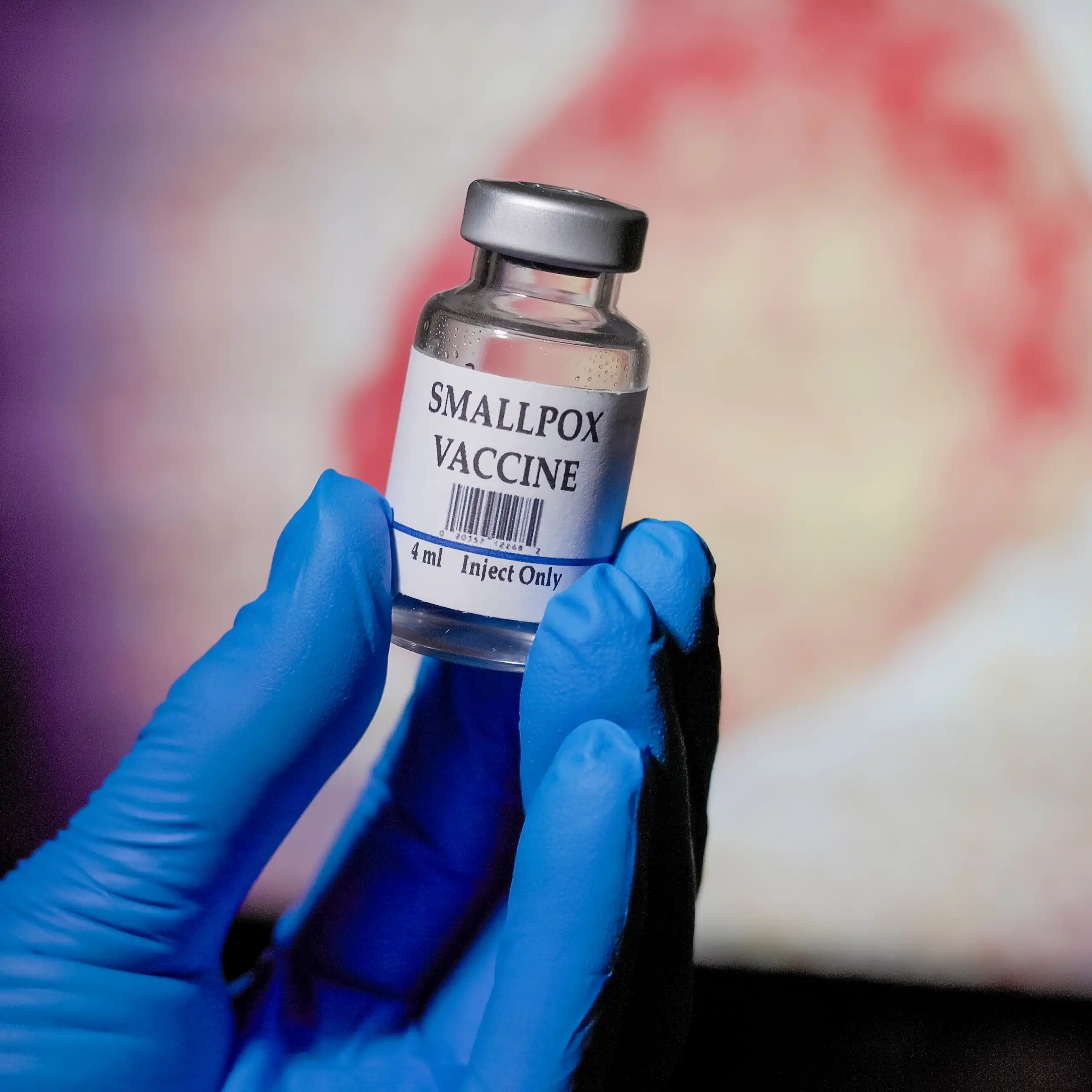 Blue gloved hand holding a vial of smallpox vaccine in front of the monkeypox virus graphic on a monitor
