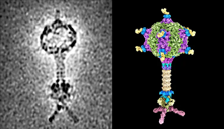 Two distinct side-by-side images of a bacterium that is shaped like a round ball on a stick, the left image in black and white, the right image in bright blue, pink and green.