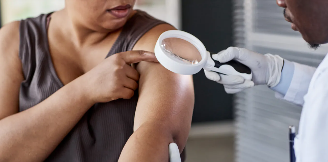 AI Skin Cancer Detection Tools Are Improving—But Primarily for Lighter Skin Tones AI Skin Cancer Detection Tools Are Improving—But Primarily for Lighter Skin Tones