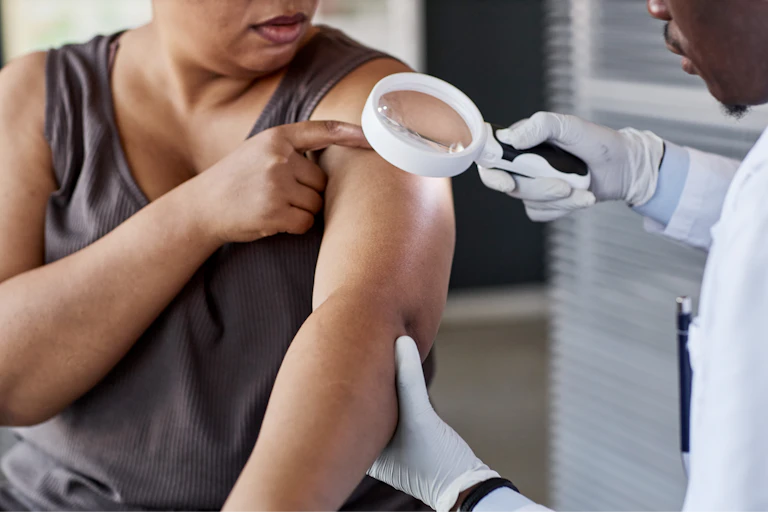 A doctor uses a magnifying glass to examine moles on a patient's shoulder.