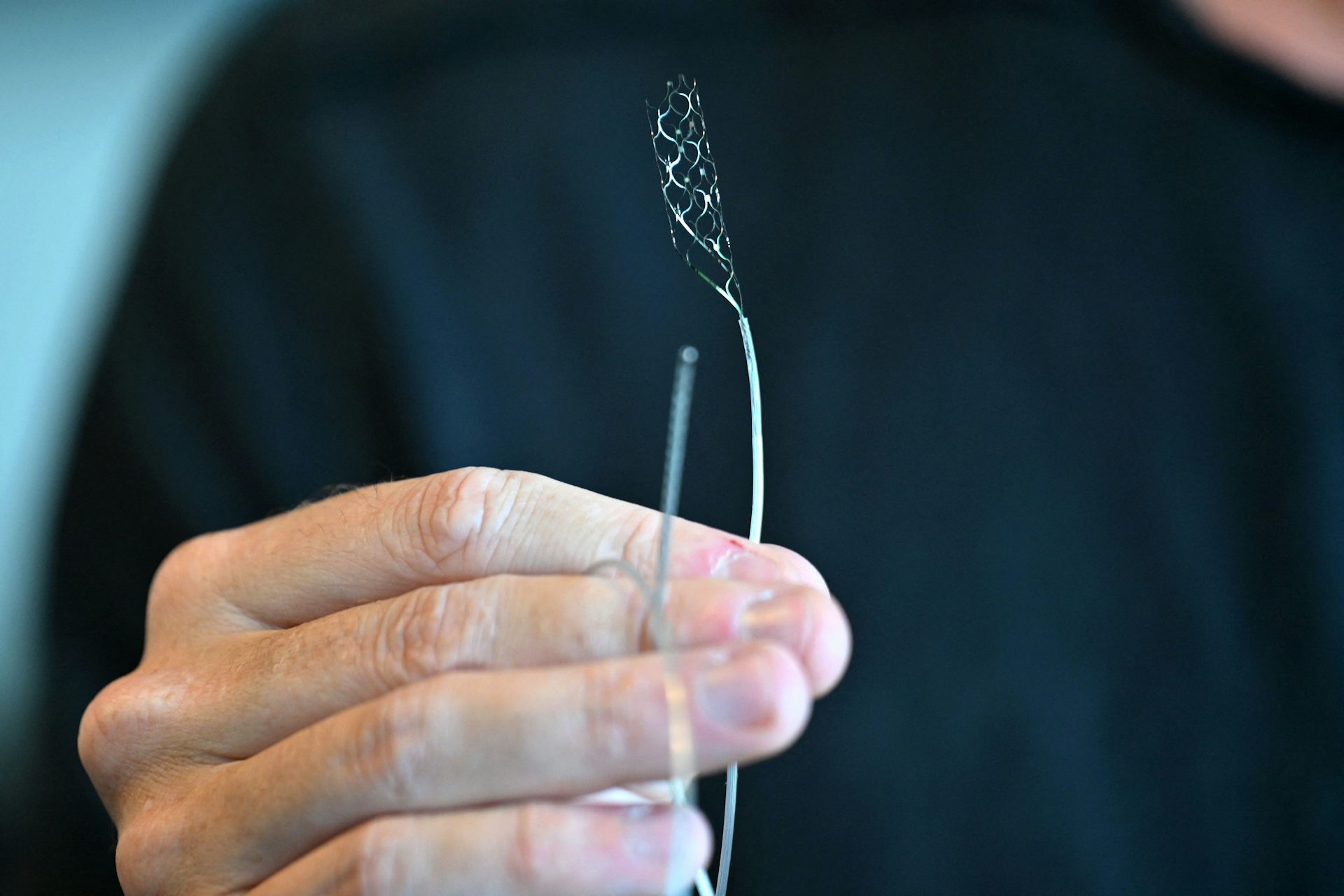 Experimental brain implants are on the rise. What happens after the trials are over?