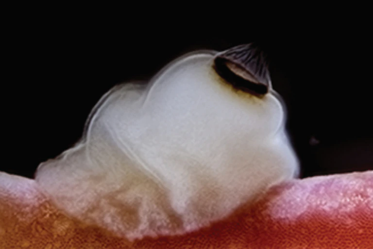 Triptich of photos of a slowly decaying blob
