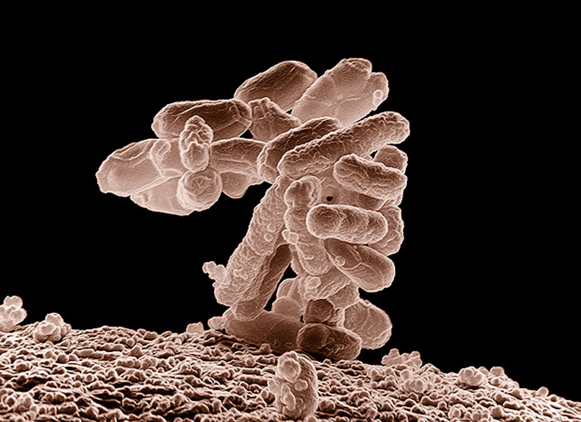 Microscopy image of a cluster of rod-shaped bacteria rising up from a surface in a cluster