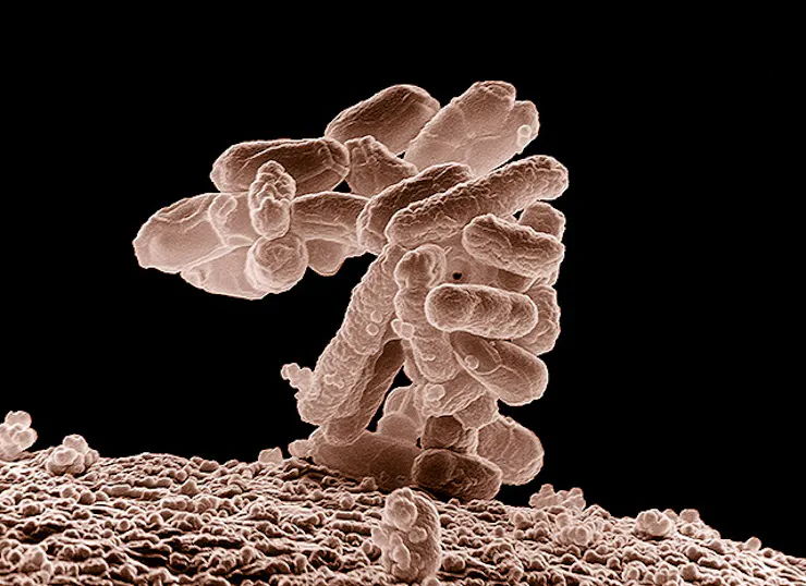 Microscopy image of a cluster of rod-shaped bacteria rising up from a surface in a cluster