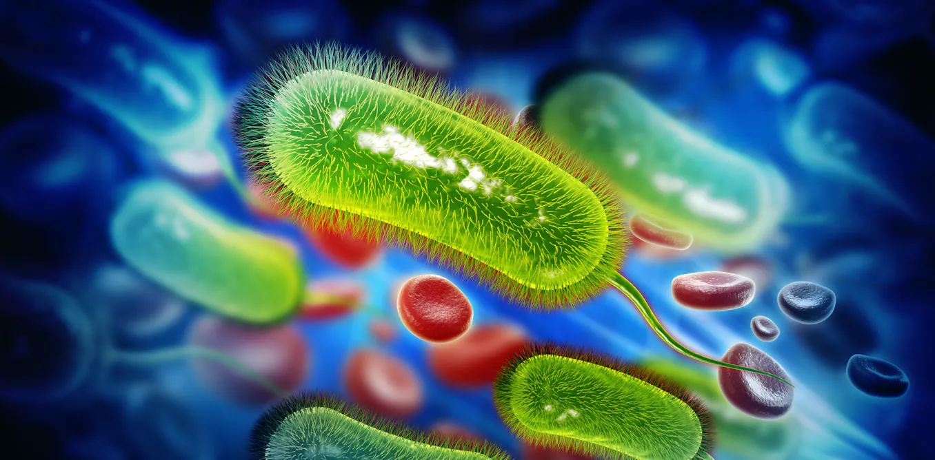 EduWireDaily — A common stomach infection may be linked to bowel cancer – here’s what we know