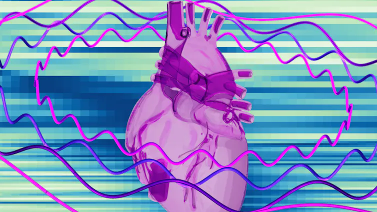 An illustration of a purple heart surrounded by wires shaped like rhythm graphs.