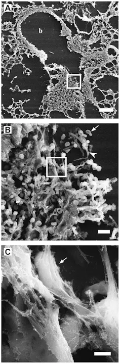 Three microscopy images of what looks like a perforated net, zooming in to reveal a mass of fibers