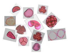 Pictures of pollen close up on slides in pink - different kinds of shapes and sizes.