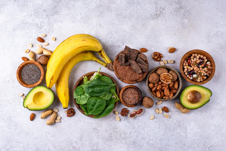 An arrangement of magnesium-rich foods, including bananas, spinach, avocado and nuts.
