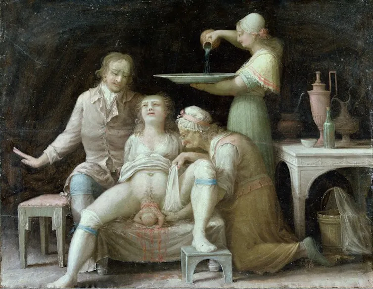 Accouchement, peinture française anonyme vers 1800