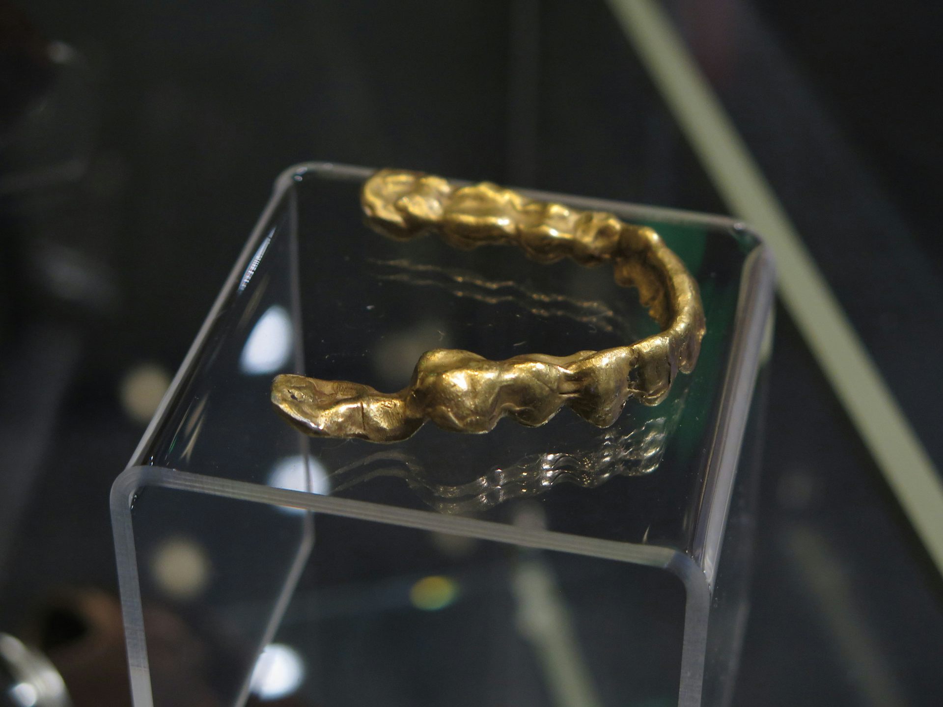 Gold caps were made for Al Graves, who was present at the Slotin accident. They protected him against the radiation from his own fillings.