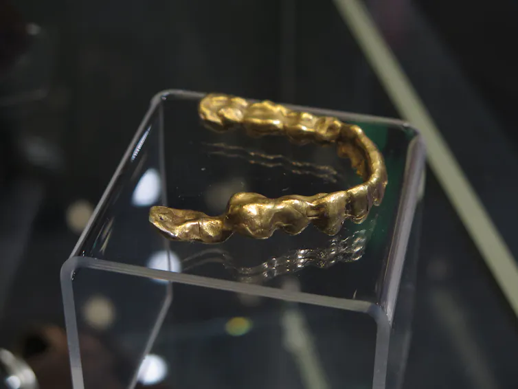 Gold caps were made for Al Graves, who was present at the Slotin accident. They protected him against the radiation from his own fillings.