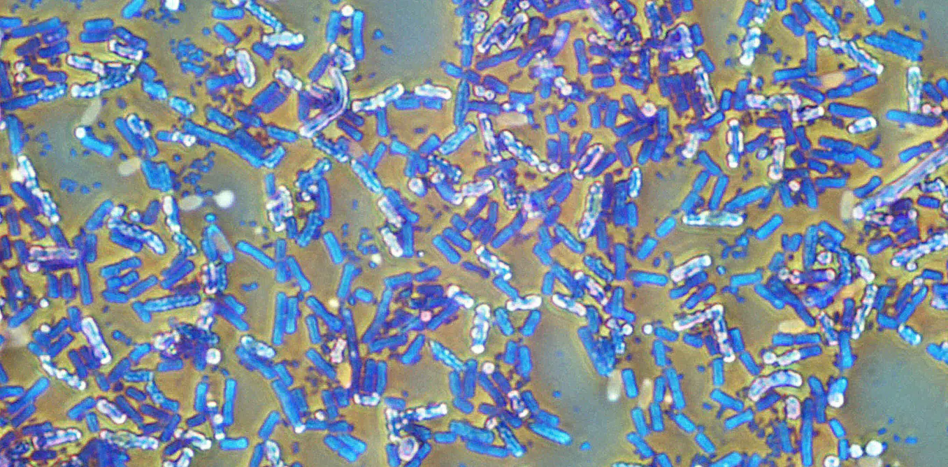 Photograph accompanying Bacterial spores cost nearly 10 billion ATP to make and revive, energy budget finds