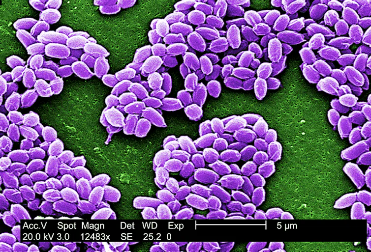 Microscopy image of thick clumps of small magenta-colored spheres.
