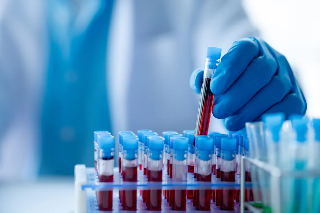 High levels of ‘forever chemicals’ found in Lancashire residents’ blood – what I’ve learned from studying exposed communities for over a decade