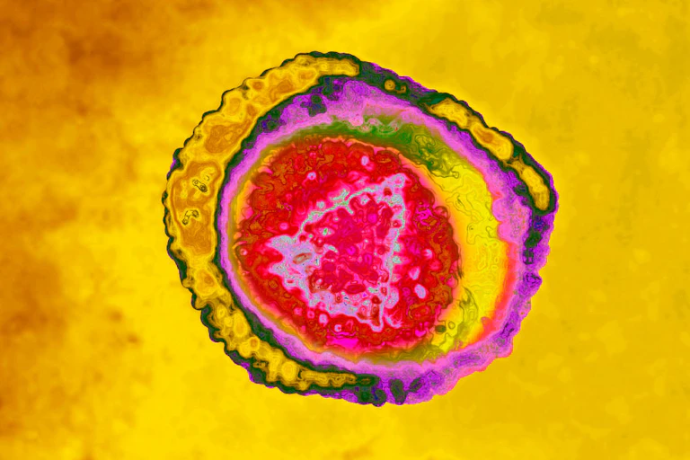 Image en microscopie du virus varicelle-zona (fausses couleurs).