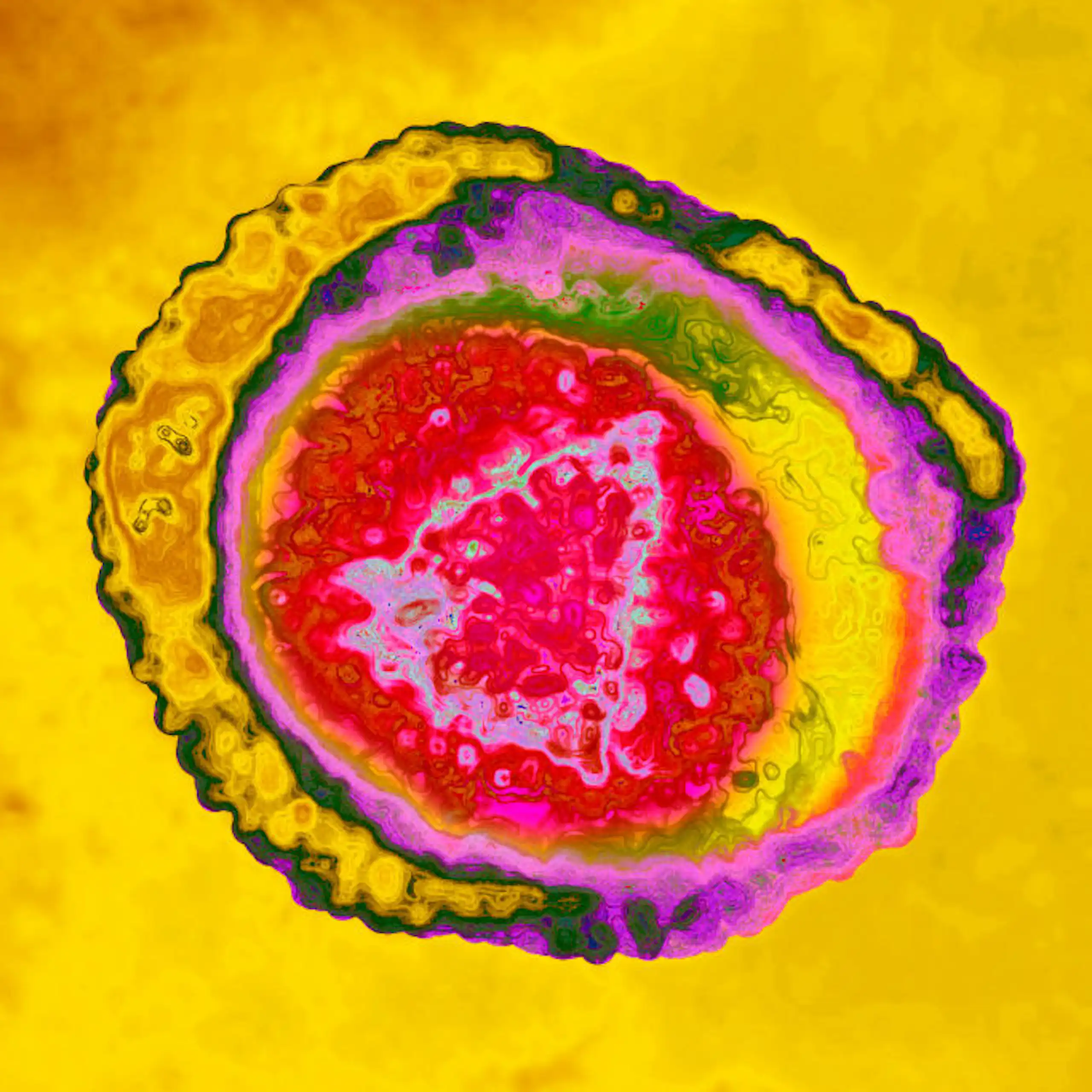Image en microscopie du virus varicelle-zona (fausses couleurs).