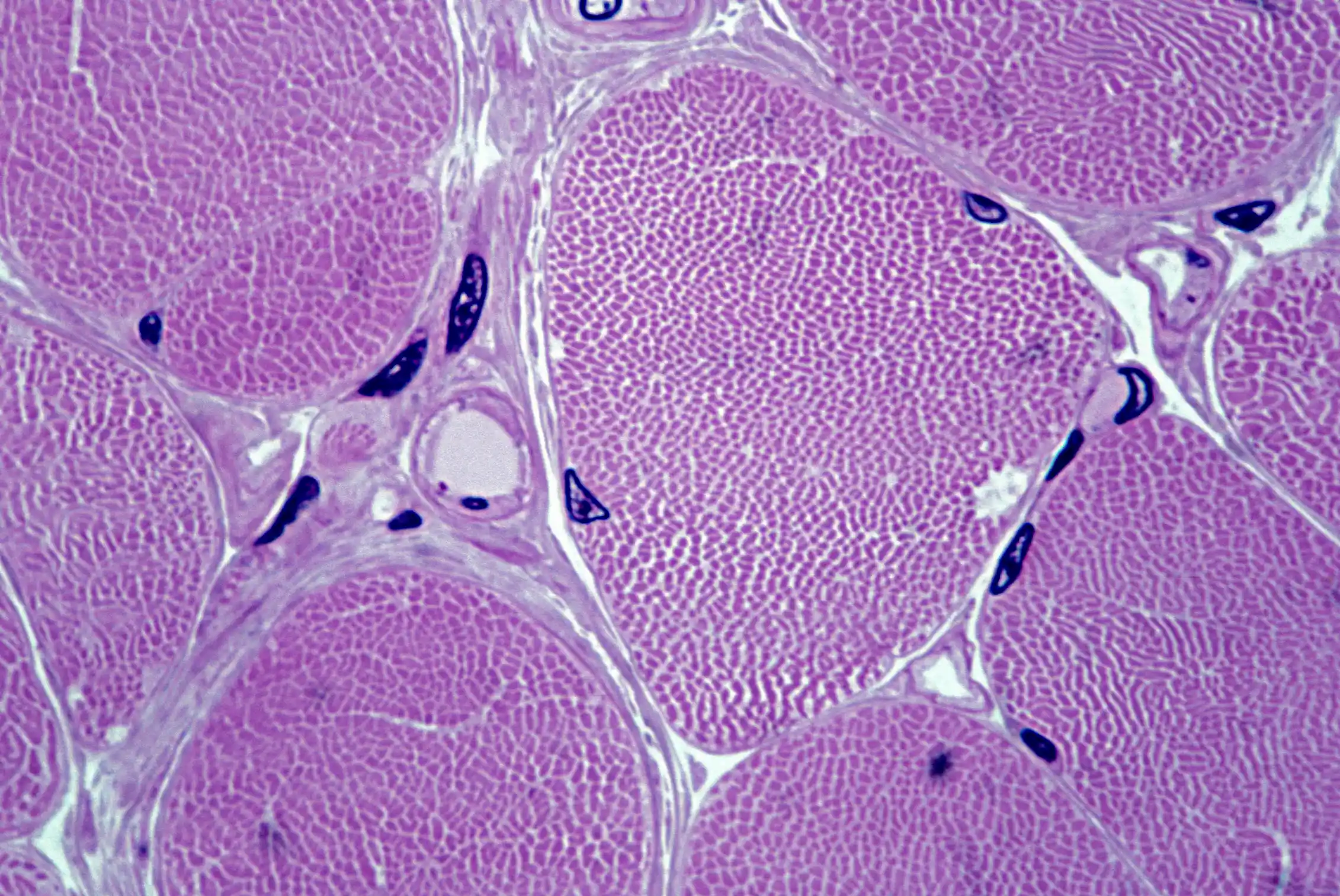Microscopy image of small pink dots enclosed within several circular membranes