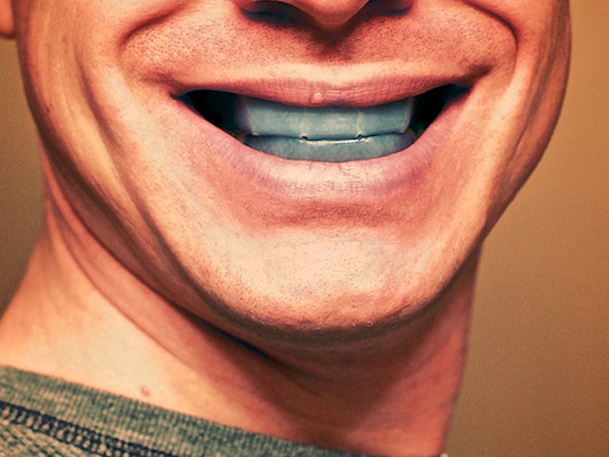 What Happens When Teeth Whitening Goes Wrong What Happens When Teeth Whitening Goes Wrong