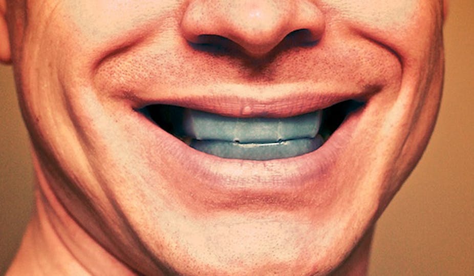 What happens when teeth whitening goes wrong?