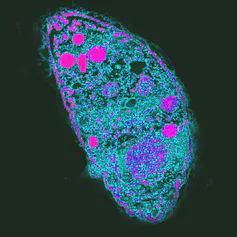 Microscopy image of an oblong blob with smaller circles within