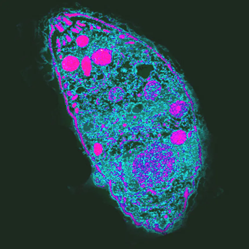 Microscopy image of an oblong blob with smaller circles within