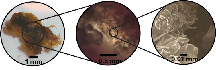 earwax magnified