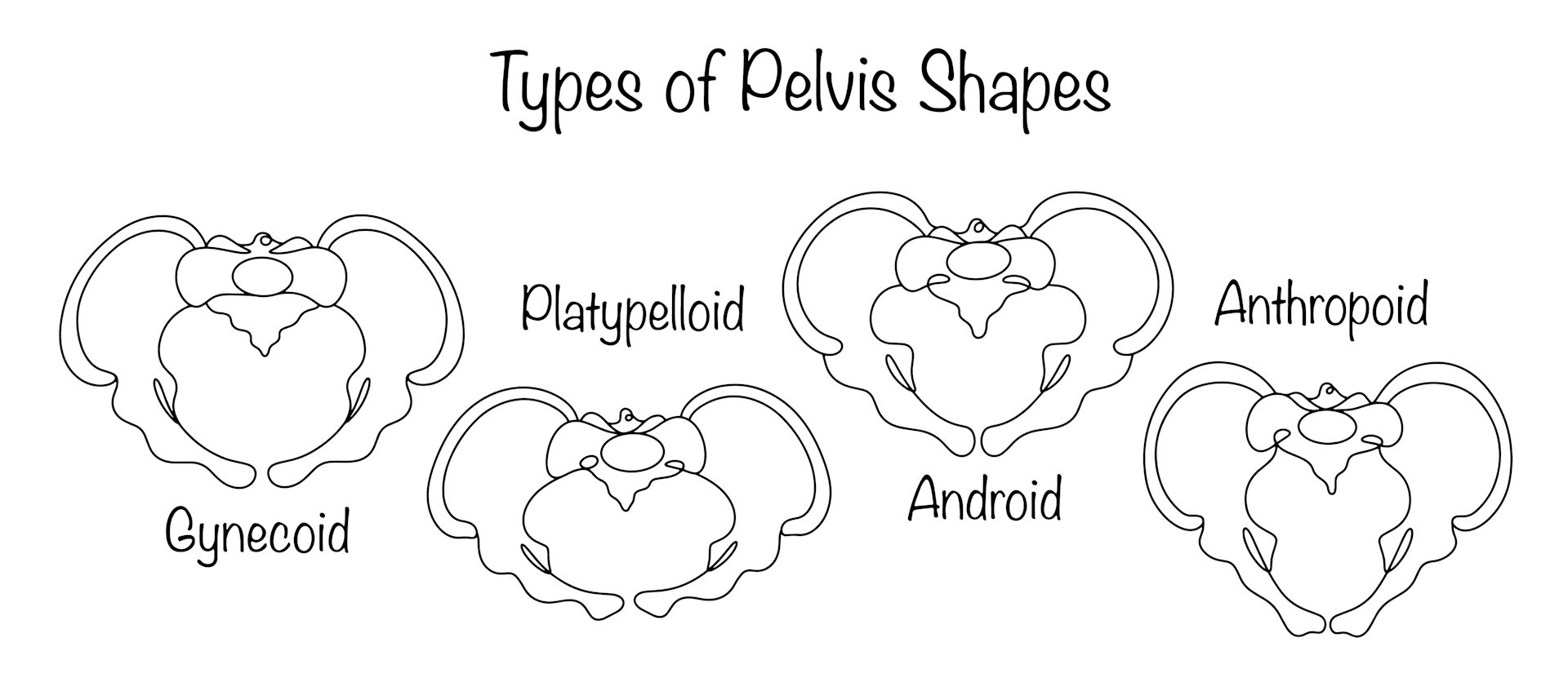 The four bony pelvis shapes.