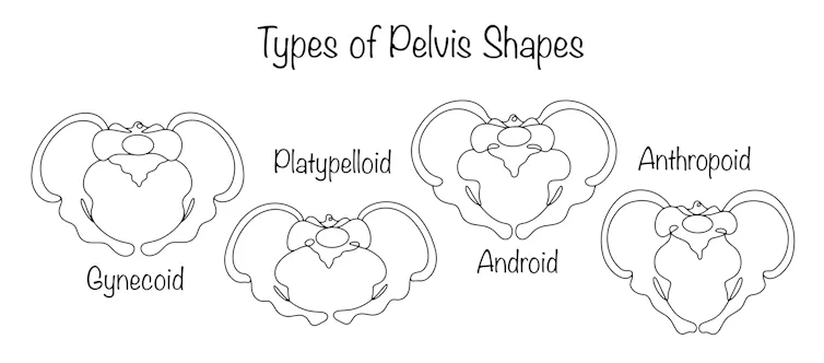 The four bony pelvis shapes.