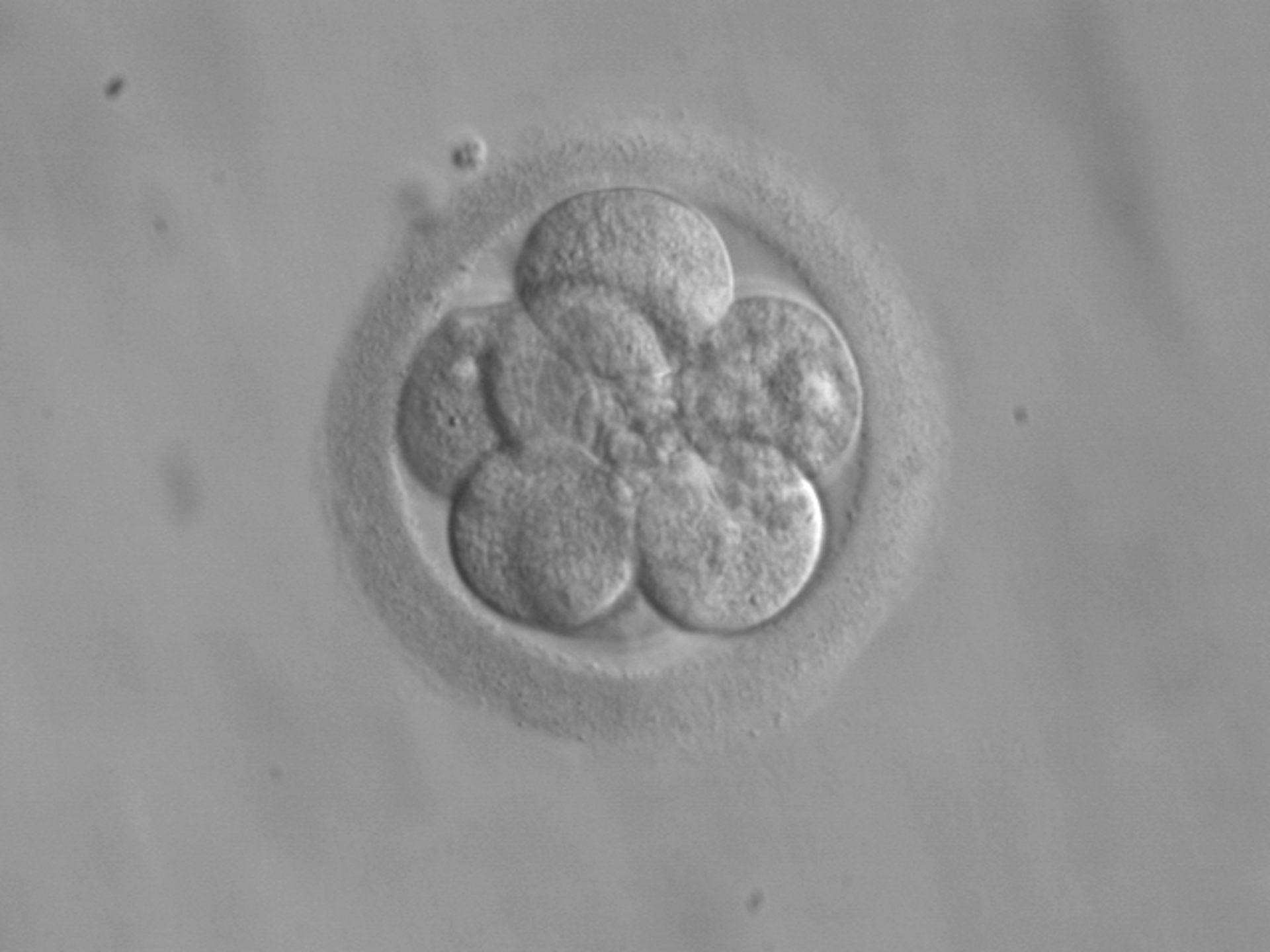 Un embryon humain au stade 8 cellules (3ᵉ jour après fécondation environ)