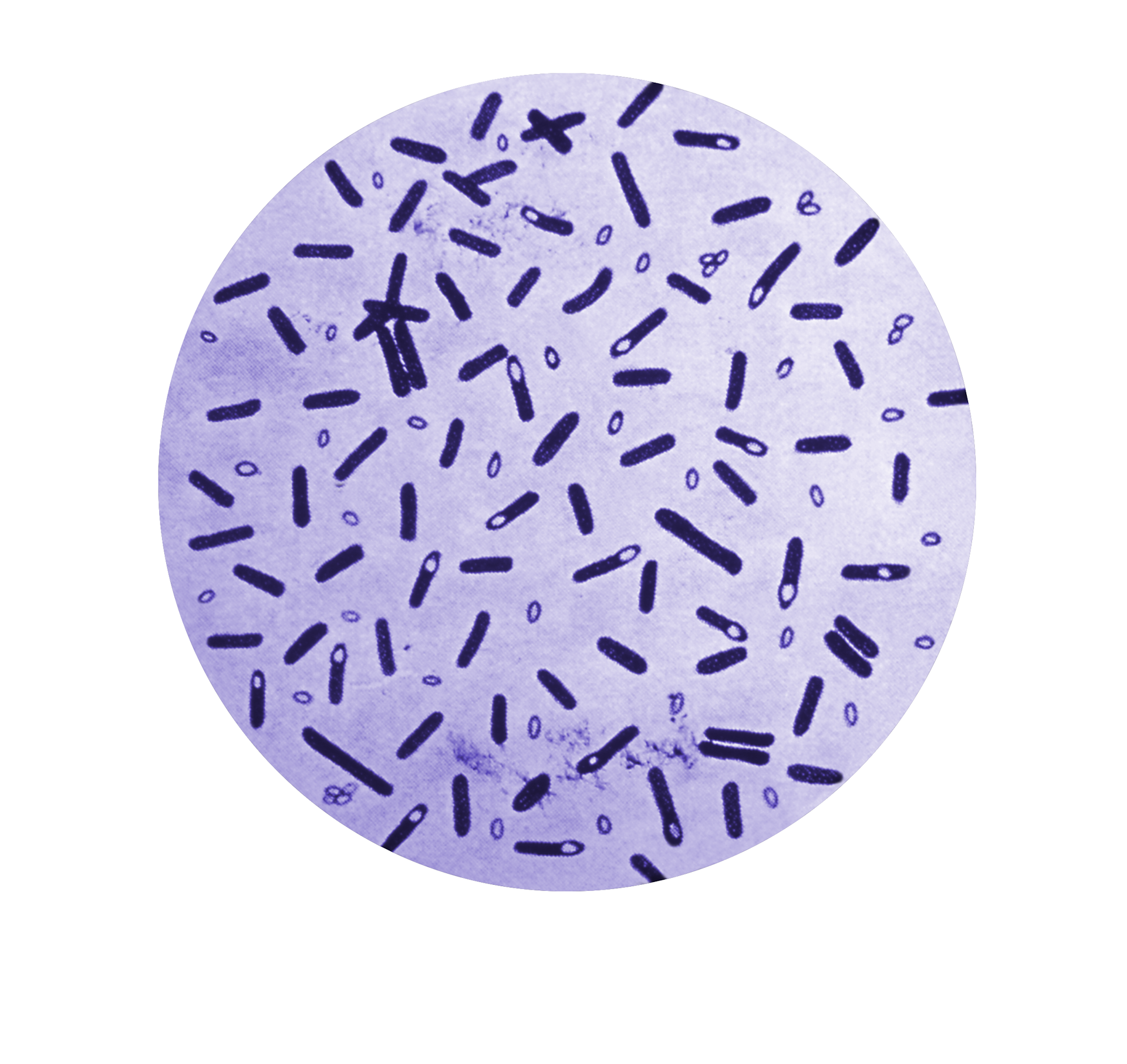 Microphotographie d'un échantillon de culture de bactéries _Clostridium botulinum_ coloré au violet de gentiane.