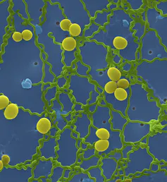 Micrographie électronique de bactéries du genre Leptospira.