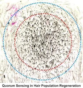 Curing Baldness May Just Be About Having Enough Pluck Curing Baldness May Just Be About Having Enough Pluck