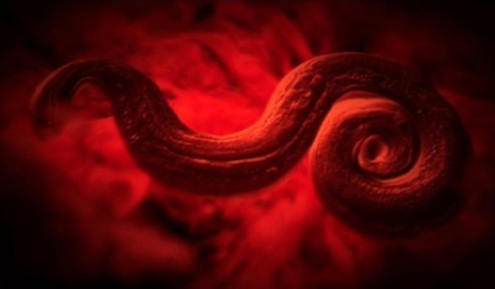 are hookworms in humans deadly
